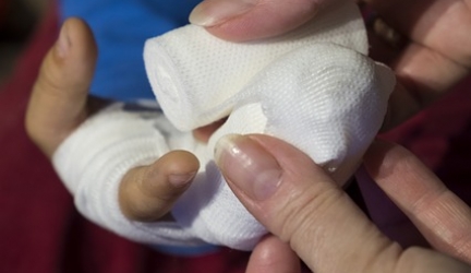 Termite Bites – Prevention and Treatments (Natural)