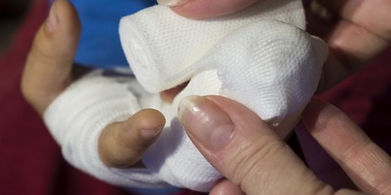 Termite Bites – Prevention and Treatments (Natural)